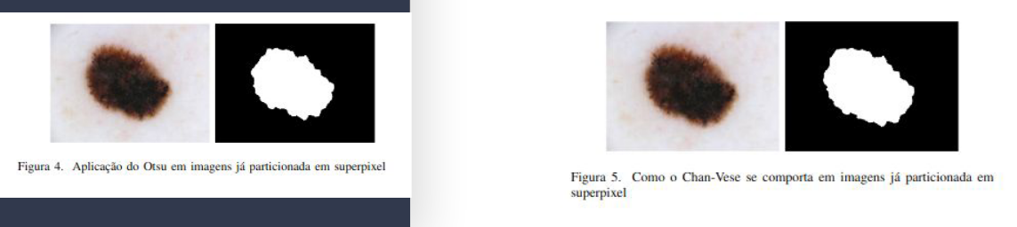 Otsu e Chan-Vese