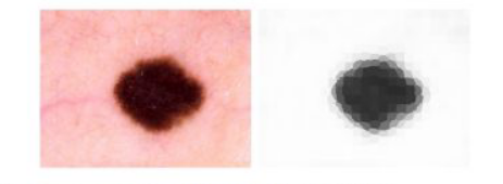 Segmentação em 450 superpixels de lesão de pele